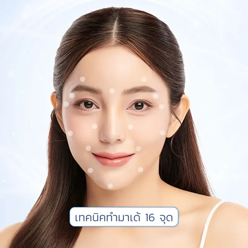 ฉีดมาเด้ 16 จุด