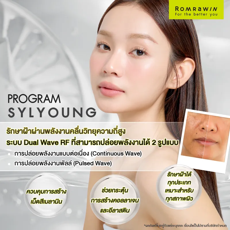 รวมโปรแกรมรักษาฝ้าของรมย์รวินท์