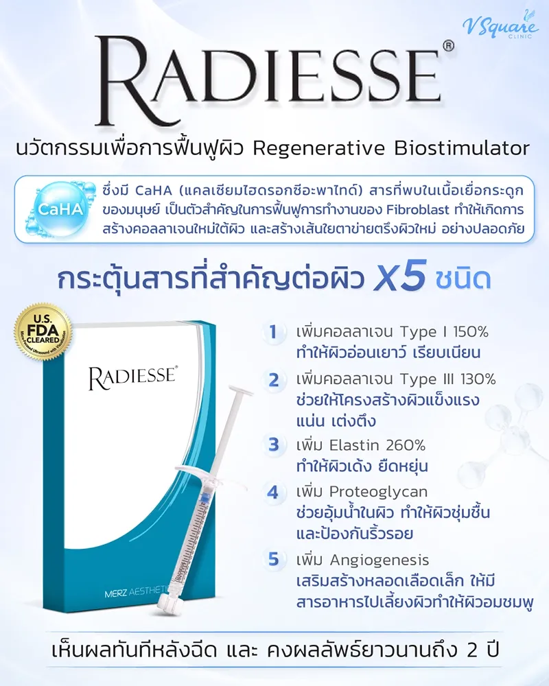 Radiesse Filler