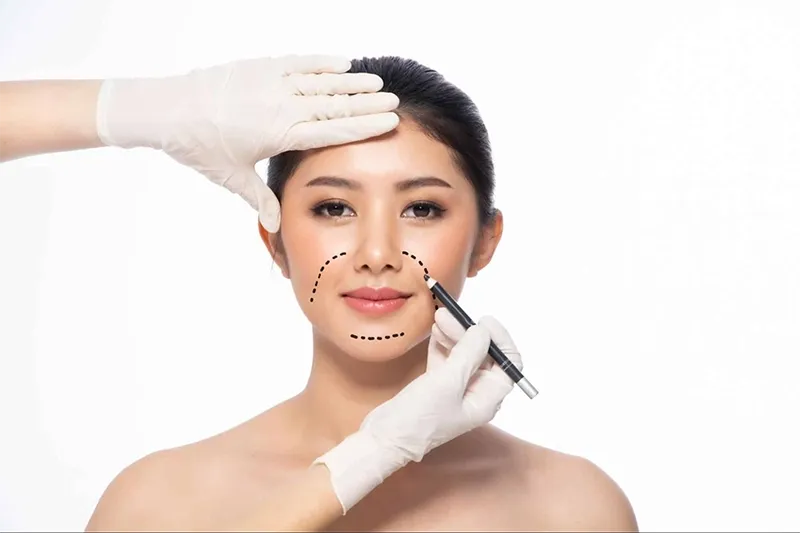 ผ่าตัดยกกระชับ แก้ร่องแก้มลึก ผ่าตัดยกกระชับ แก้ร่องแก้มลึก