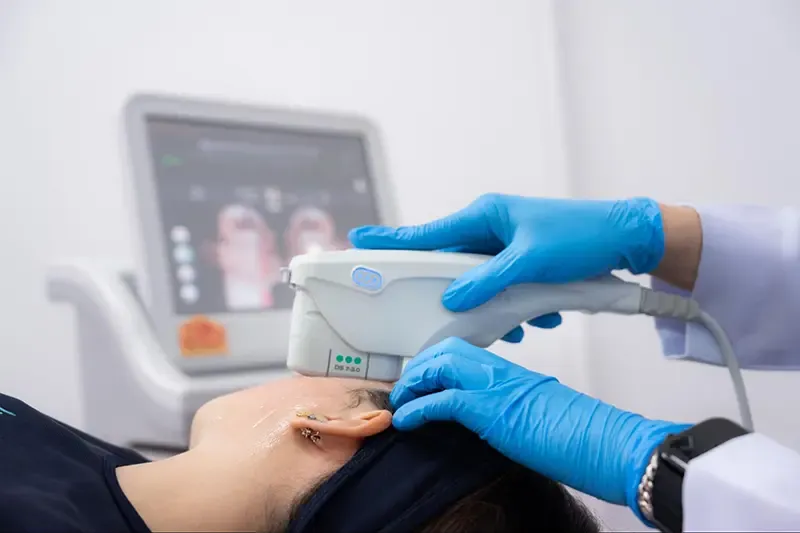 รีวิว Ulthera บริเวณแก้ม