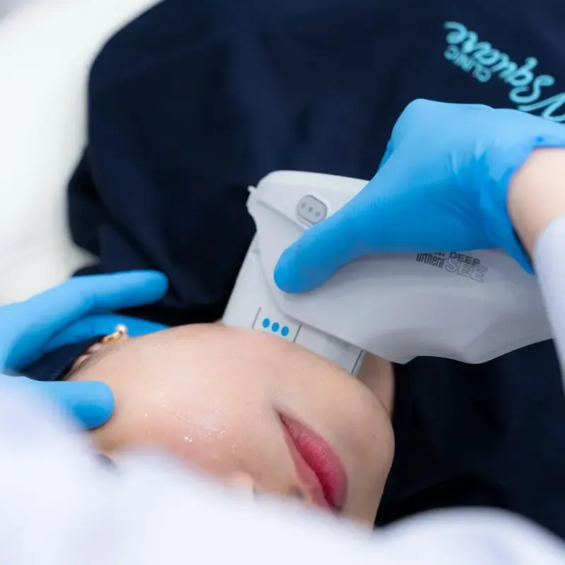 รีวิวทำอัลเทอร่ากรอบหน้าและลดเหนียง