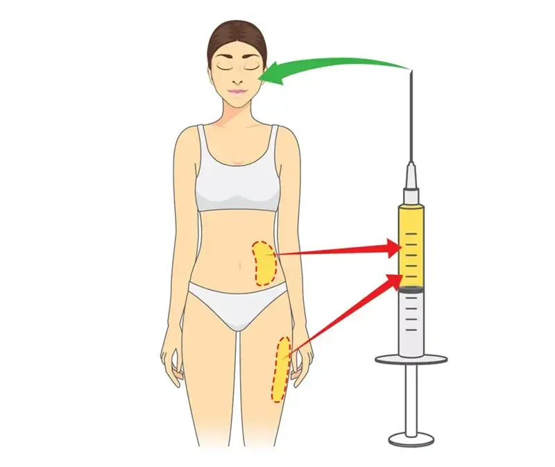 ฉีดไขมันใต้ตา vs Filorga ฉีดใต้ตา