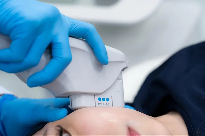 Ulthera Prime แก้มเหนียง ราคา