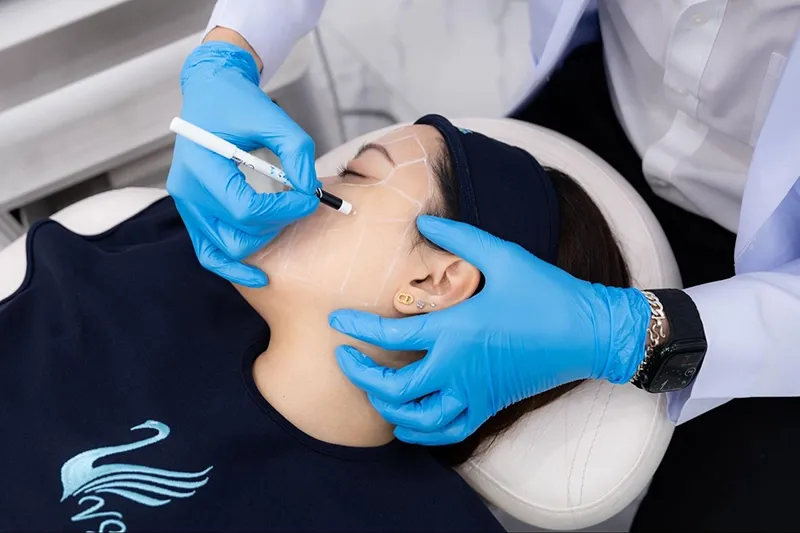 ราคา Ulthera Prime รอบดวงตา