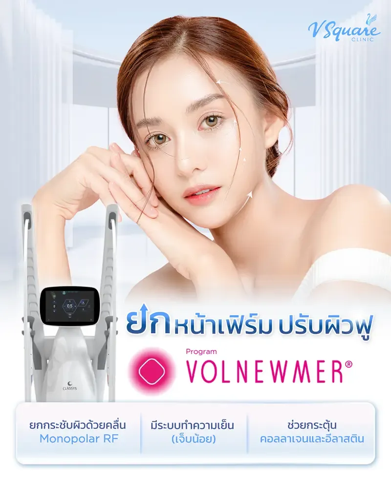 เครื่อง Volnewmer