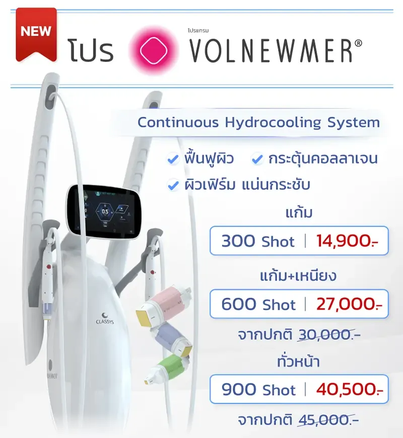 Volnewmer ราคา