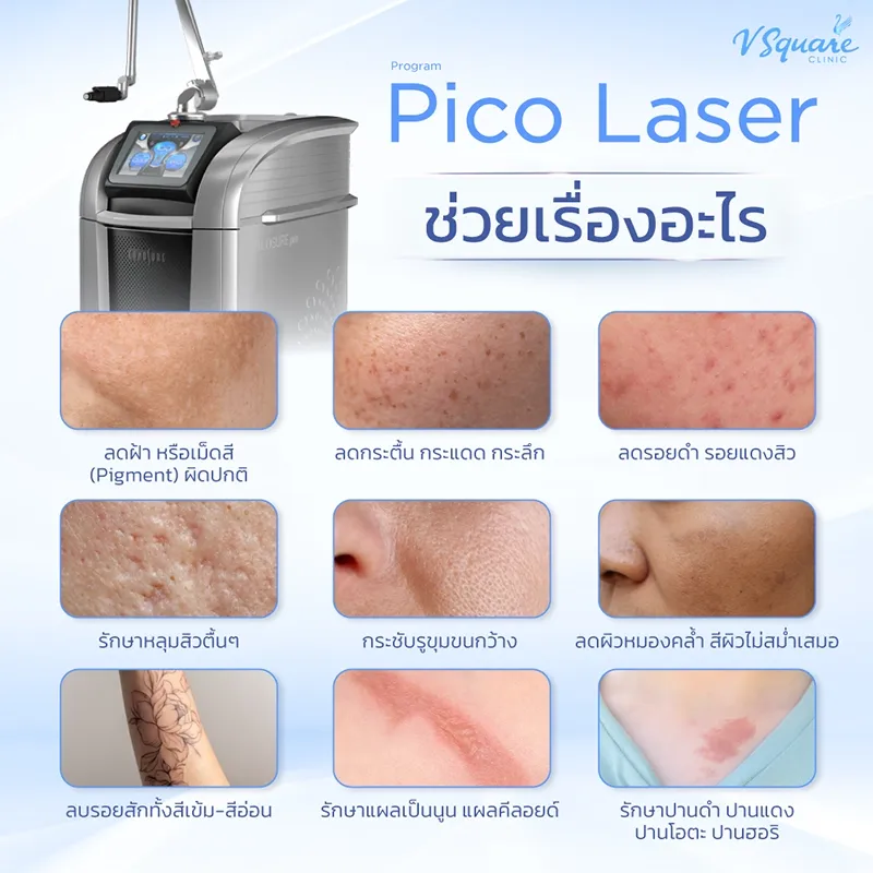 Pico Laser ช่วยเรื่องอะไร