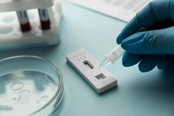 หยอดน้ำยาและสารคัดหลั่งลงแผ่นทดสอบ