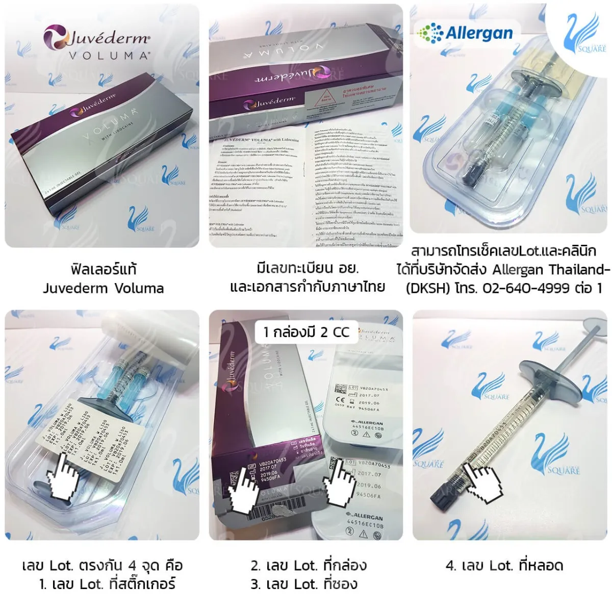 วิธีดูฟิลเลอร์ใต้ตา Juvederm Voluma วิธีดูฟิลเลอร์ใต้ตา Juvederm Voluma