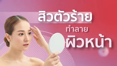 สิว..ตัวร้าย ทำลายผิวหน้า